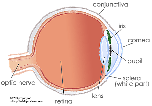 eye conditions